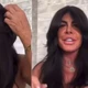 Imagem - Gretchen faz nova harmonização facial e mostra resultado sem filtro