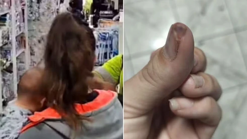 Imagem - Mãe tem  parte do dedo arrancada a mordidas durante assalto enquanto amamentava bebê