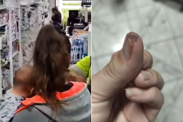 Mulher foi agredida em assalto