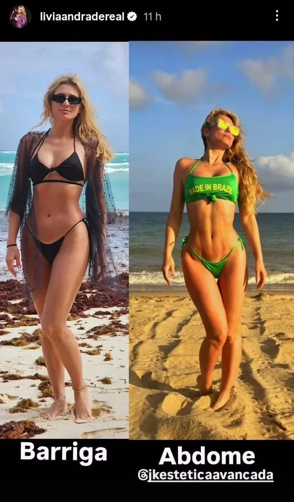Antes e depois de Lívia Andrade por  Reprodução/Instagram
