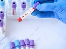 Imagem - MP não é votada no prazo e famílias de crianças afetadas por zika vivem incerteza sobre indenização