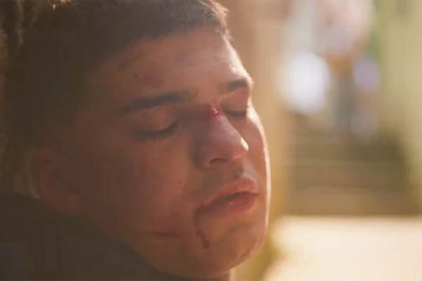 Lucas após agressões em 