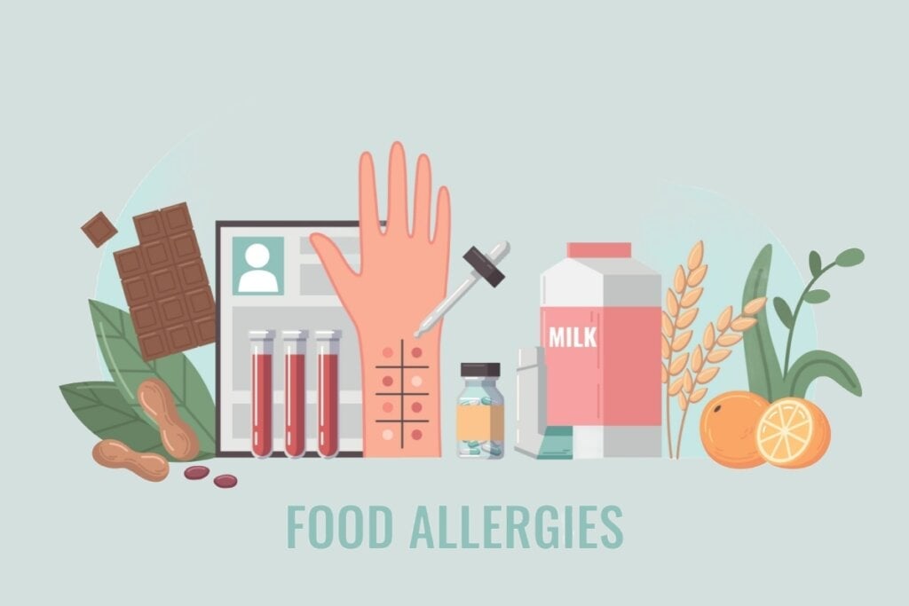 Alguns cuidados são importantes para prevenir as crises da alergia alimentar (Imagem: Macrovector | Shutterstock)