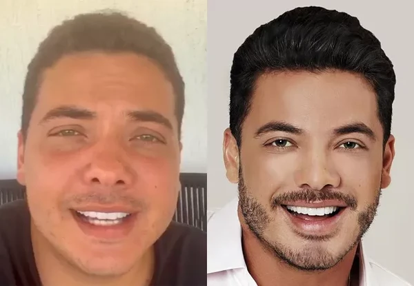 Safadão fez harmonização facial por Reprodução