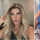 Imagem - Íris Stefanelli surge irreconhecível após lifting no rosto e desabafa: 'Nada de rugas'