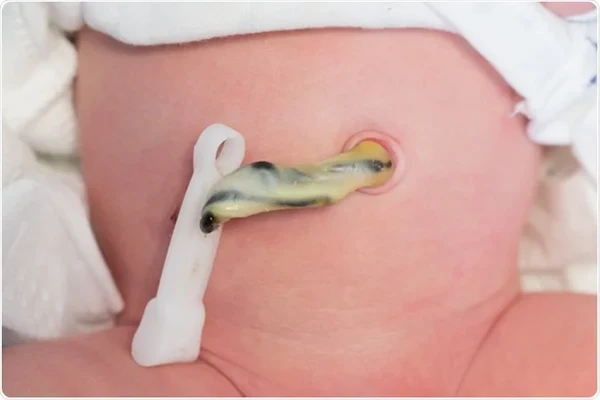 Cordão umbilical por Shutterstock