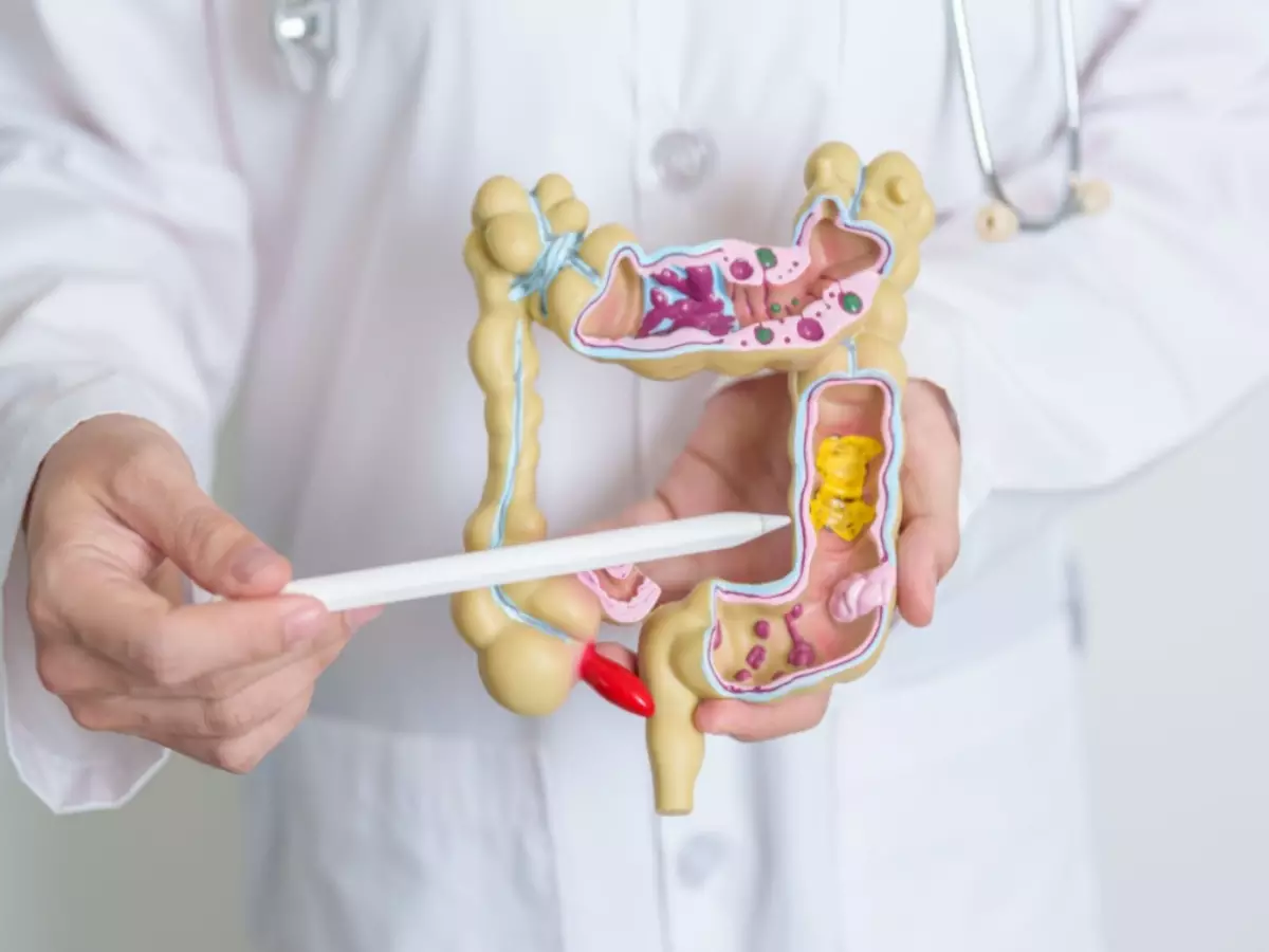 Câncer de cólon por Shutterstock