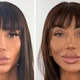 Imagem - Quanto custa? Pode causar cegueira? Veja o que se sabe sobre cirurgia que muda cor dos olhos