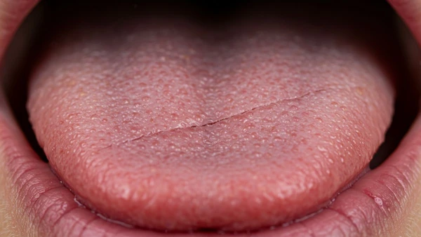 Saúde bucal e geral: o que o aspecto ondulado da sua língua pode revelar