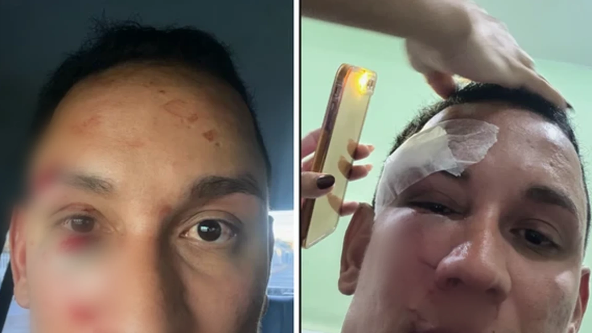 Imagem - Dentista é espancado em camarote de São João na Bahia: 'Vieram com sede de sangue'