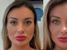 Imagem - Andressa Urach muda cor dos olhos com cirurgia e se desespera: 'Medo de ficar cega'