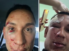 Imagem - Médico é espancado em camarote de São João na Bahia: 'Vieram com sede de sangue'