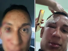 Imagem - Médico é espancado em camarote de São João na Bahia: 'Vieram com sede de sangue'