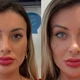 Imagem - Andressa Urach muda cor dos olhos com cirurgia e se desespera: 'Medo de ficar cega'