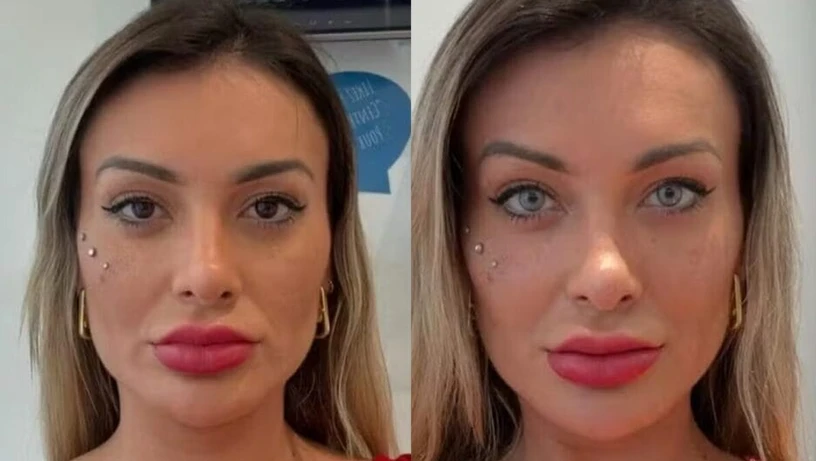 Imagem - Andressa Urach muda cor dos olhos com cirurgia e se desespera: 'Medo de ficar cega'