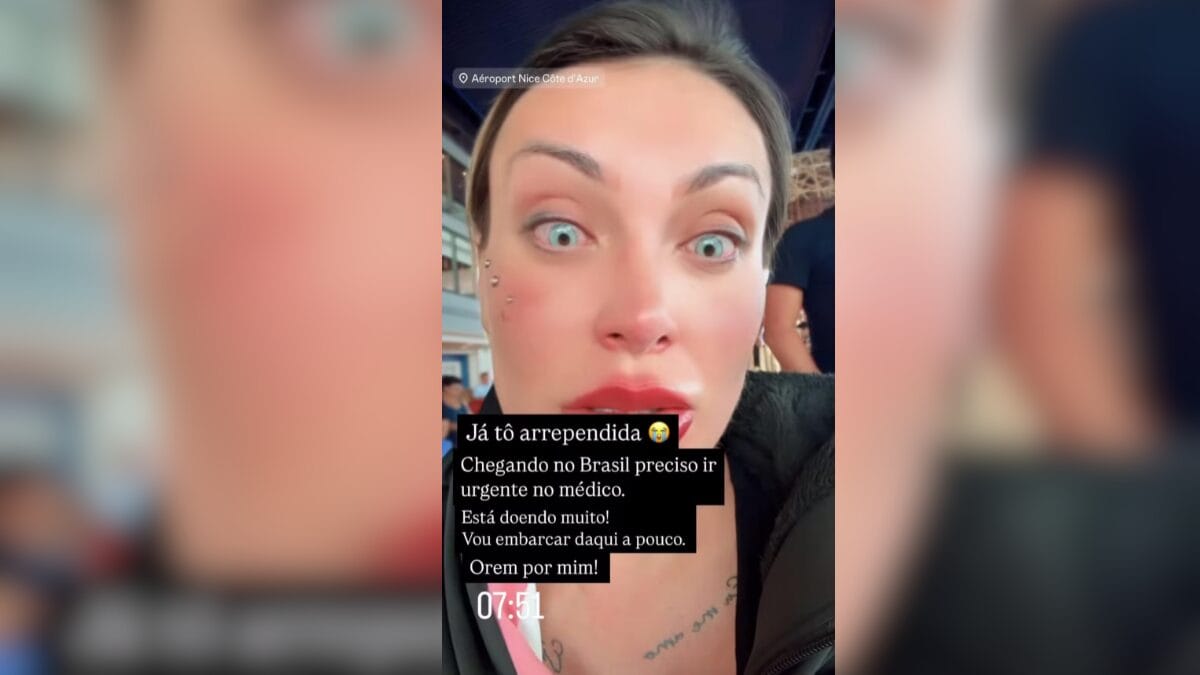 Andressa Urach muda cor dos olhos com cirurgia e se desespera ao sentir fortes dores por Reprodução/Redes Sociais 