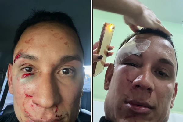 Médico postou vídeo mostrando ferimentos