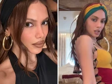 Imagem - Procedimento mal sucedido? Anitta esclarece o que fez no rosto
