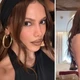 Imagem - Procedimento mal sucedido? Anitta esclarece o que fez no rosto