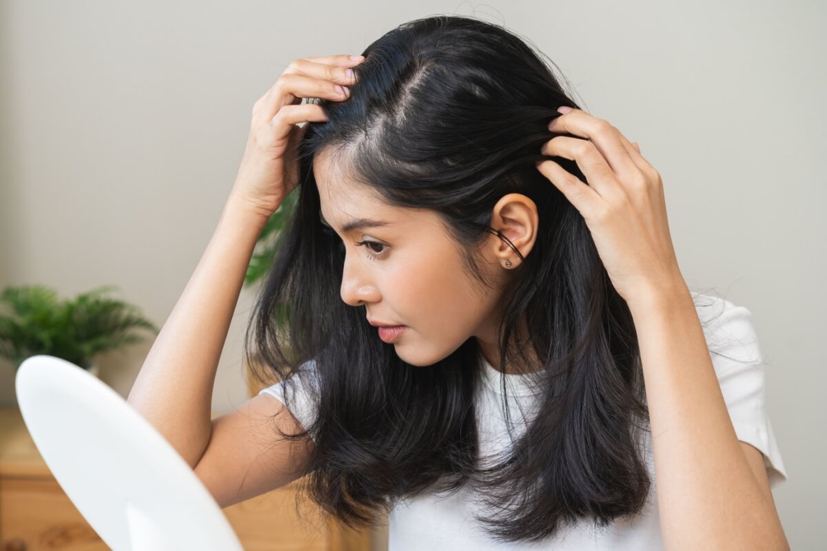 Cuidados simples ajudam a tratar a caspa sem agredir os cabelos (Imagem: Kmpzzz | Shutterstock) 
