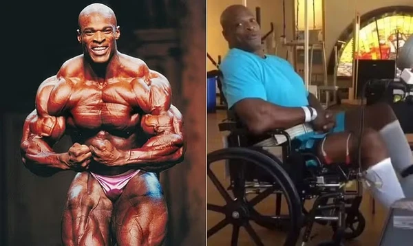 Ronnie Coleman é internado nos EUA com infecção grave 