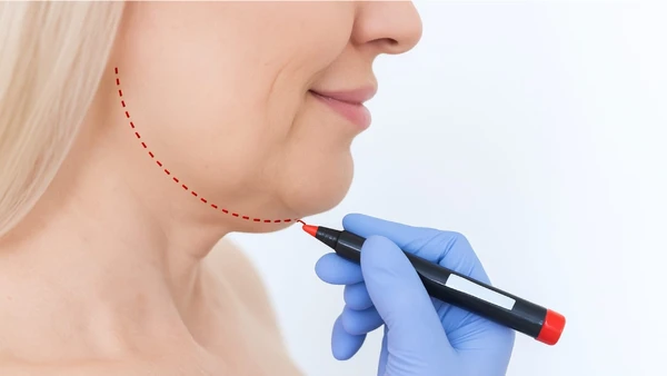 Descubra os melhores procedimentos e hábitos para reduzir a papada e valorizar o contorno facial