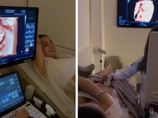 Imagem - Rafa Kalimann relembra perda gestacional ao mostrar ultrassom da filha Zuza: 'Bebê arco-íris'