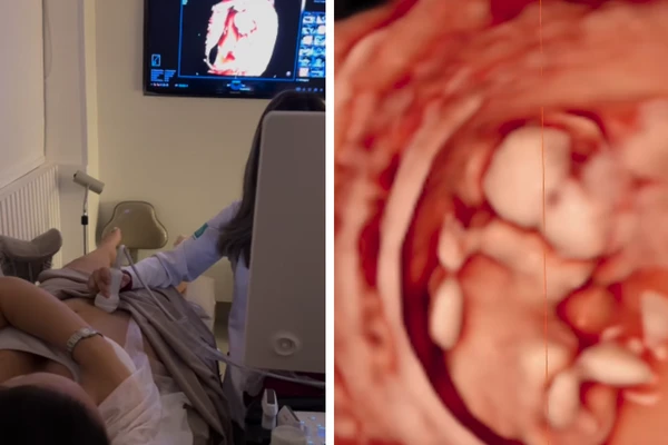 Rafa Kalimann mostra ultrassom da filha Zuza por Reprodução / Instagram