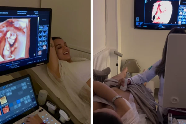 Rafa Kalimann mostra ultrassom da filha Zuza