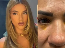 Imagem - Mulher alega cegueira após usar produto de Virginia