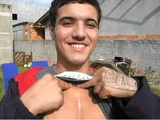Imagem - Jovem escapa da morte por milímetros após ter prego cravado no peito: 'Um milagre'