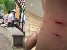 Imagem - Cães de rua atacam em grupo moradores e fazem mais de 30 vítimas