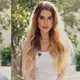 Imagem - O que é Síndrome de Sjögren, doença autoimune rara diagnosticada na ex-BBB Fernanda Keulla