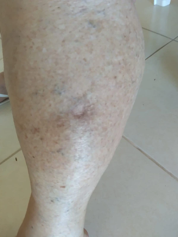 Cães de rua atacam moradores: mais de 30 vítimas  por Reprodução