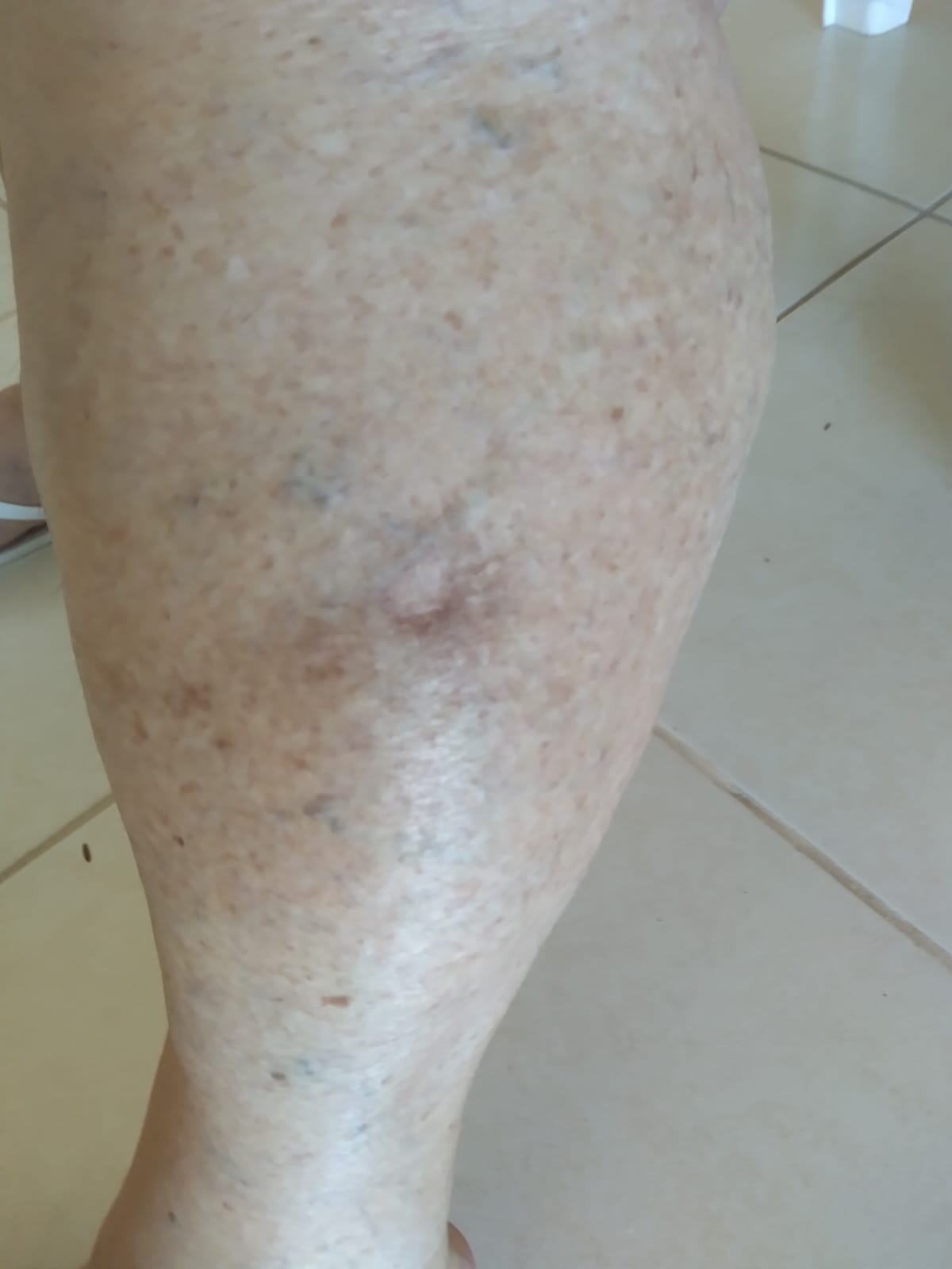 Cães de rua atacam moradores: mais de 30 vítimas  por Reprodução
