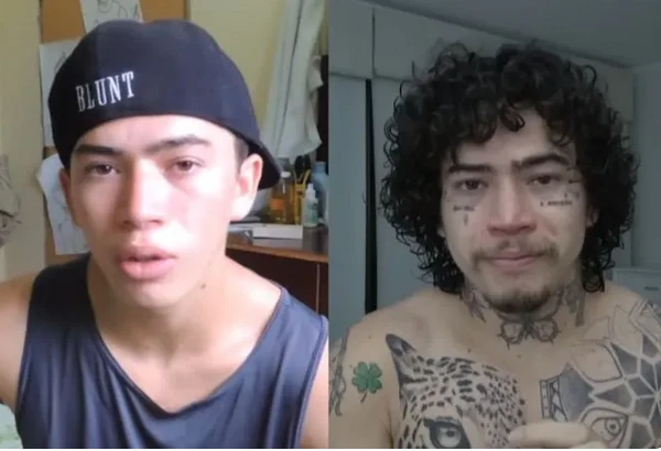 Diversos famosos aderiram as cirurgias e procedimentos estéticos