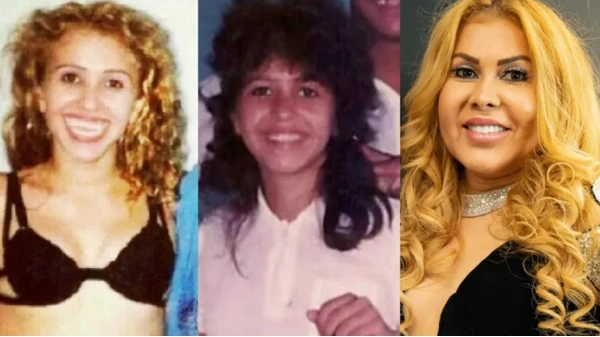 Diversos famosos aderiram as cirurgias e procedimentos estéticos