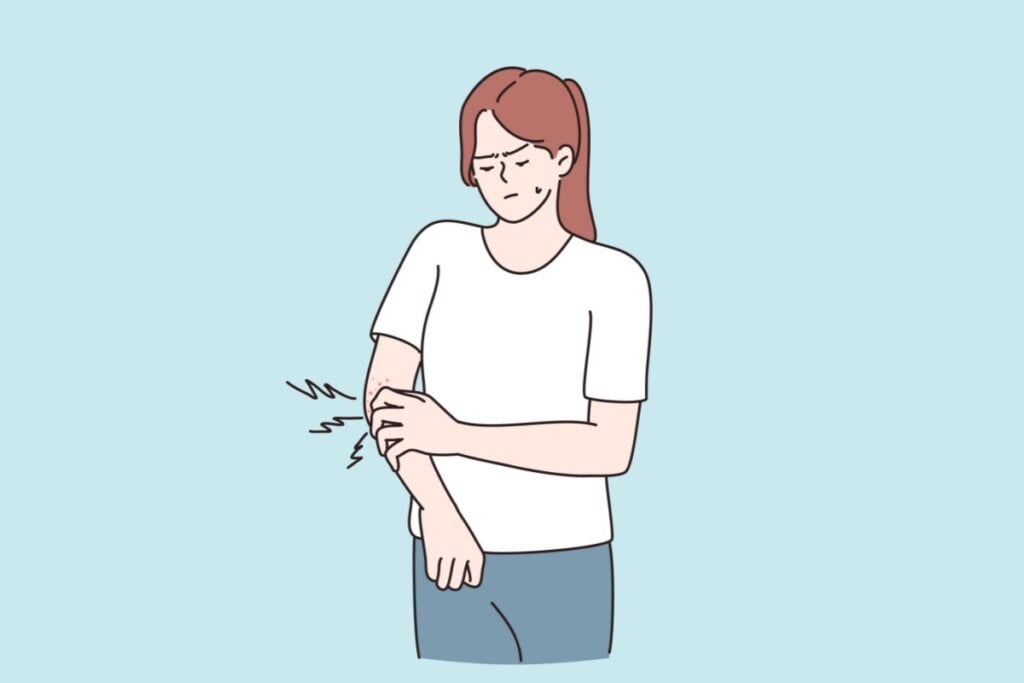 Os sintomas de alergia alimentar variam de leves a graves e podem incluir sintomas como a urticária (Imagem: Vectorium | Shutterstock)