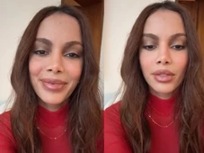 Imagem - Anitta reaparece nas redes sociais e rebate críticas a plásticas: 'Não tenho que ficar postando'