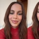Imagem - Anitta reaparece nas redes sociais e rebate críticas a plásticas: 'Não tenho que ficar postando'