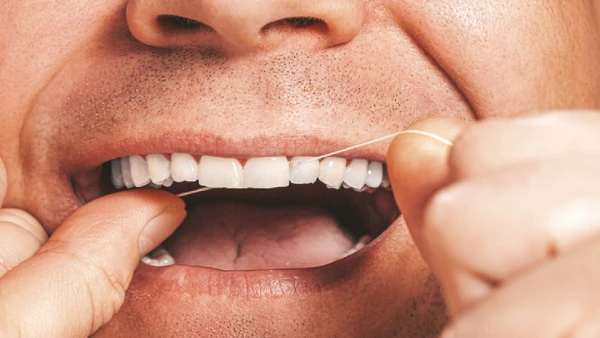 Fio dental é muito importante para manter dentição