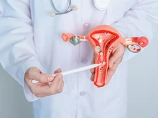 Imagem - Como identificar miomas no útero? Especialistas detalham sintomas e diagnóstico