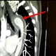 Imagem - Mulher rompe aorta durante relação sexual e é levada às pressas para cirurgia