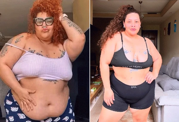 Aila Menezes antes da bariátrica (à esquerda) e sete meses depois da cirurgia (à direita) por Reprodução/Redes Sociais 