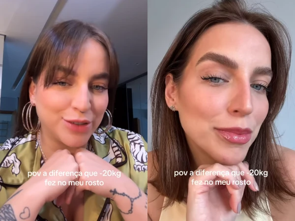 Bruna Unzueta antes e depois por Reprodução/Instagram