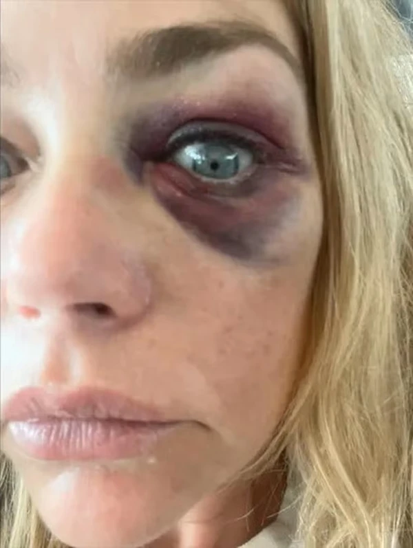 Denise Richards por Reprodução/TMZ