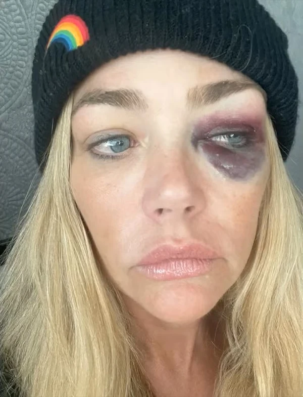 Denise Richards por Reprodução/TMZ