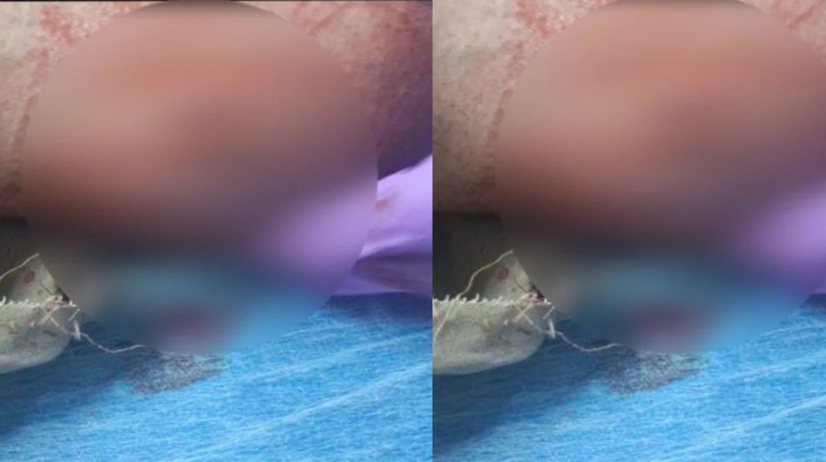 PM é atacado por pitbull após comando de traficante no Pau Miúdo 
