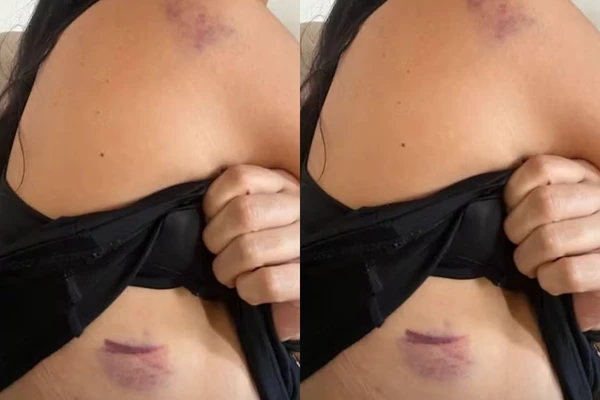 Vítima ficou ferida por Reprodução/ TV Bahia