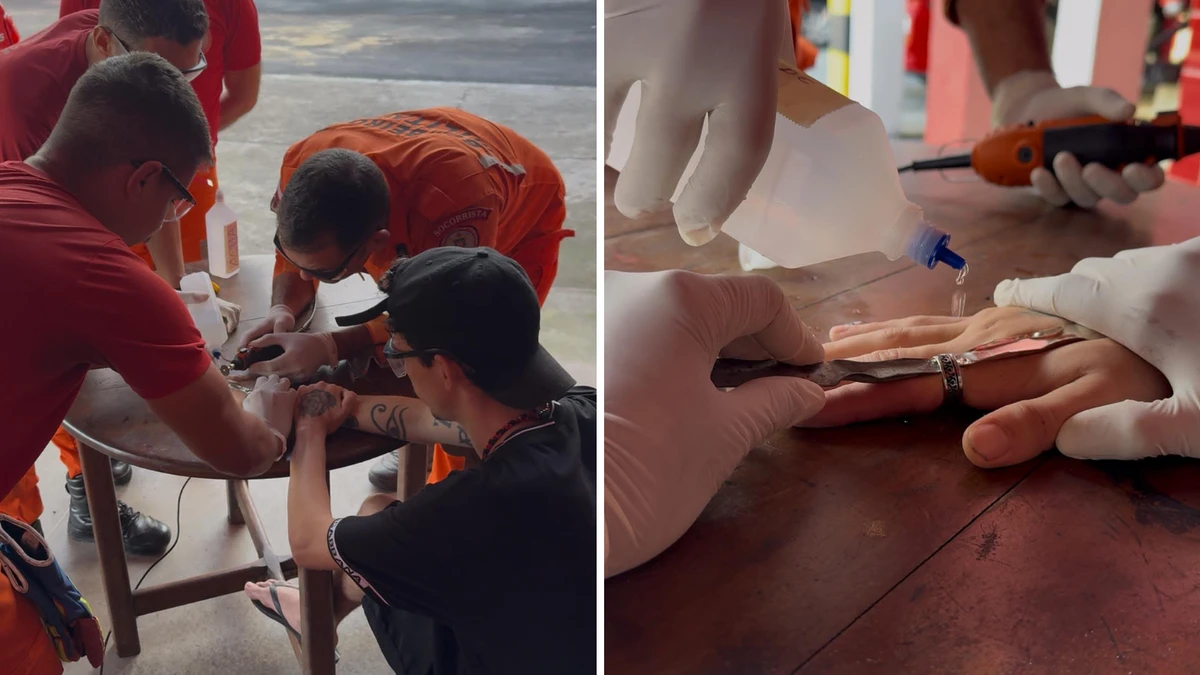 Equipe utilizou micro retilínea para retirar acessório